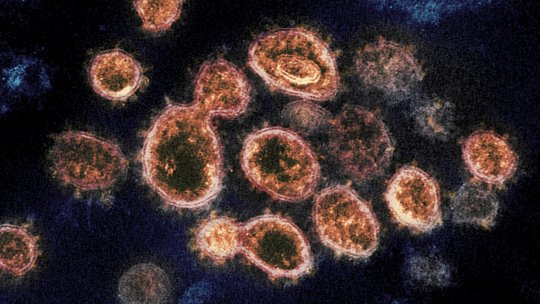  Reporterka švedske državne televizije bila prisiljena da prestane sa istraživanjem vezanim za curenje virusa iz WUHANA!