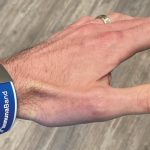 NARKUVICE ZA VAKCINISANE SPREMNE ZA UPOTREBU! Naučnici kažu: Immuna Band, donosi slobodu?