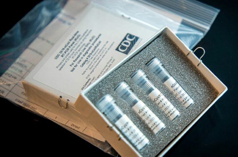 VELIKA VEST! CDC POVLAČI IZ UPOTREBE PCR TEST ZA COVID - TEST NE MOŽE NAPRAVITI RAZLIKU IZMEĐU VIRUSA GRIPA I COVID-a