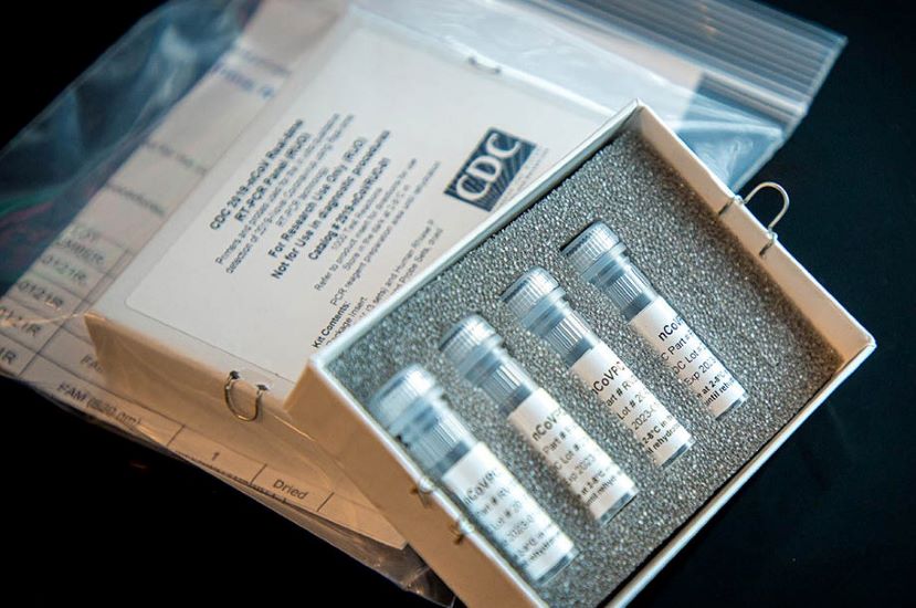  VELIKA VEST! CDC POVLAČI IZ UPOTREBE PCR TEST ZA COVID – TEST NE MOŽE NAPRAVITI RAZLIKU IZMEĐU VIRUSA GRIPA I COVID-a