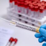 PROFESOR ONKOLOGIJE: HISTERIJA OPSESIVNOG TESTIRANJA NA COVID JE KAO SAMOPOVREĐIVANJE