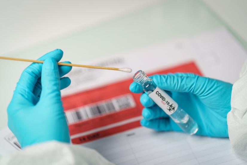  VELIKA VEST: CDC prizno da nalazi PCR testa završavaju u laboratorijama za genomsko sekvenciranje