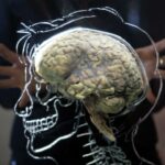 Prvi put skeniran mozak koji umire i otkriva poslednje trenutke