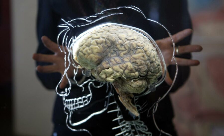  Prvi put skeniran mozak koji umire i otkriva poslednje trenutke