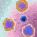 Izbijanje hepatitisa povezano sa nedostatkom socijalizacije zbog blokada usled Kovida