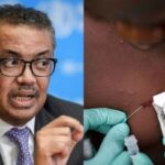 SZO UPOZORAVA: Letnji festivali i masovna okupljanja bi mogla da UBRZAJU ŠIRENJE MAJMUNSKIH BOGINJA