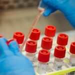 ŠPANIJA digla uzbunu zbog novih slučajeva "MISTERIOZNOG" HEPATITISA kod dece