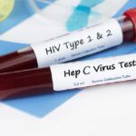 U Srbiji oboren rekord obolelih od HIV-a, u Zagrebu epidemija hepatitisa