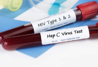 U Srbiji oboren rekord obolelih od HIV-a, u Zagrebu epidemija hepatitisa