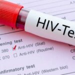 U Srbiji oko 4.000 ljudi ima HIV, povećan broj zaraženih zbog većeg obima testiranja?