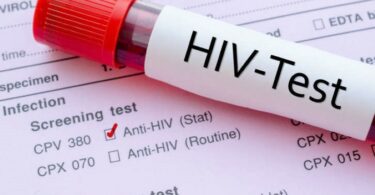 U Srbiji oko 4.000 ljudi ima HIV, povećan broj zaraženih zbog većeg obima testiranja?
