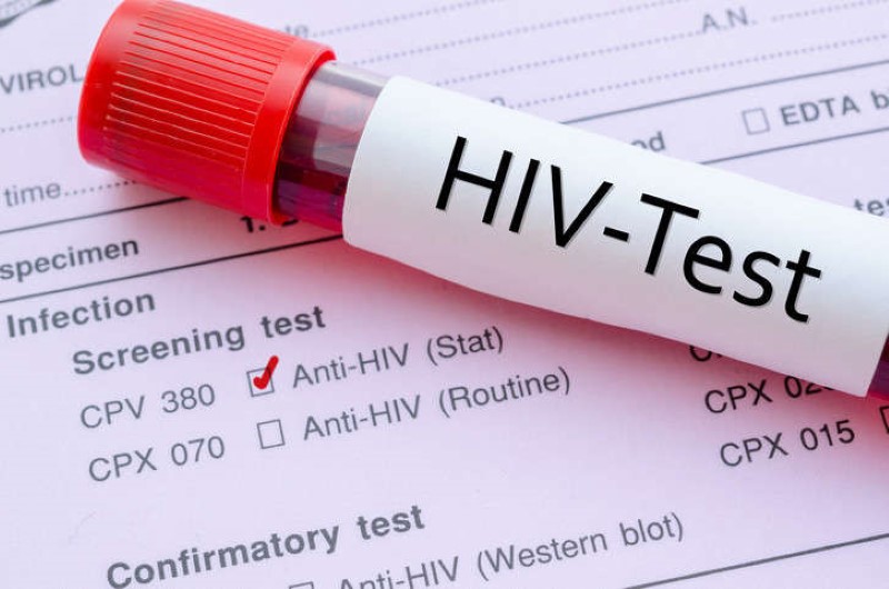  U Srbiji oko 4.000 ljudi ima HIV, povećan broj zaraženih zbog većeg obima testiranja?