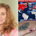 Belgija je postala prva zemlja koja je uvela obavezni karantin za majmunske boginje