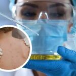 Dr Radmilo Petrović o MAJMUNSKIM BOGINJAMA: Neko je možda mućkao u laboratorijama vidimo da neke zemlje imaju tajne laboratorije