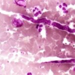 HIT! Pobuna u naučnom svetu zbog "crvljivog seksizma"! Problem zbog toga što parazitski crvi ne dobijaju ženska imena