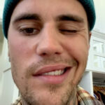 Vakcine su sigurne i efikasne?! Džastinu Biberu paralizovano lice, njegova mlada supruga doživela moždani udar pre nekoliko meseci