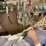 Kanađaninu koji je paralizovan zbog vakcine protiv Covid-a odobrena odšteta