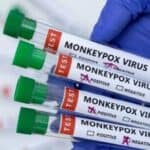 Nova studija otkriva način širenja majmunskih boginja