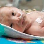 Australija beleži porast respiratornog virusa od 963% među 'pandemijskim bebama' koje nemaju imunitet