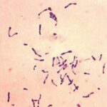 Da nije od vakcine?! Australija traži odgovore nakon što je prvi put u 100 godina prijavljena "DIFTERIJA"