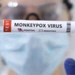 Insitut Robert Koh: Pretnja epidemije majmunskih boginja marginalna