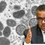 Uskoro SZO proglašava epidemiju majmunskih boginja?