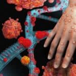 Prva smrt od majmunskih boginja u SAD