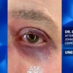 Jutjub suspendovao poznatog DOKTORA nakon što je prikazao nuspojave VAKCINE