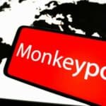 Najmanje 8 dece u SAD pozitivno je testirano na majmunske boginje