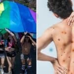 ZAPADNI MEDIJI otkrivaju da se majmunske boginje šire putem seksa među homoseksualcima