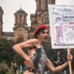 Gej albanac u Beogradu dobio po glavi: Udarali su me flašama