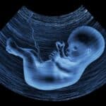 Sud u Arizoni aktivirao zakon o zabrani abortusa iz 1864