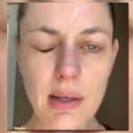 Kanadska glumica otkrila da JE DOBILA PARALIZU dve nedelje nakon vakcinacije, kaže da bi to ponovo uradila