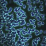 Recenzirana studija: 94% vakcinisanih pacijenata sa kasnijim zdravstvenim problemima ima abnormalnu krv