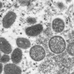 Kineske vlasti upozoravaju stanovništvo da ne dodiruje strance zbog MAJMUNSKIH BOGINJA