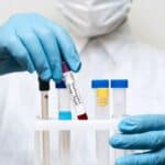 SAD: Laboratorija u Merilendu stvara SMRTONOSNIJI SOJ majmunskih boginja