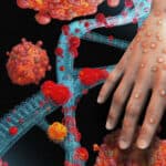 Direktor infektivne klinike: Epidemija majmunskih boginja nije pred gašenjem