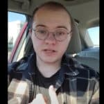 Devojka koja je uzimala testosteron 5 godina oćelavila