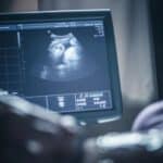 Procureli bolnički imejl otkriva eksploziju mrtvorođenih beba nakon uvođenja vakcine protiv COVID-a