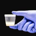 Nova studija otkriva zabrinjavajuću budućnost za ČOVEČANSTVO! Broj spermatozoida opao za 62%