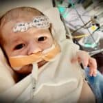 Beba umrla od masivnog krvnog ugruška nakon što je bolnica odbila transfuziju nevakcinisane krvi