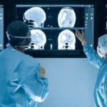 Britanski lekari upozoravaju na „najveću krizu zbog oboljenja od raka“