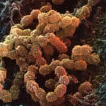 MEDIJI tragično izveštavaju o smrtnim slučajevima od streptokoke u Velikoj Britaniji ali ne spominju MOGUĆE UZROKE