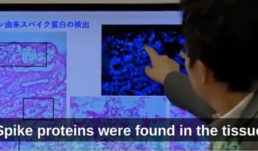 Japanski istraživači istražuju vezu između vakcina protiv Covida i smrti i teških neželjenih efekata