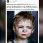 Ukrajinska poslanica lažno prikazala „žrtvu“ ruskog udara