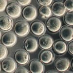 U SRBIJU stigao prvi kontigent "doniranih" jajnih ćelija iz ŠPANIJE