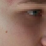 Otac srpskog dečaka (15) kojeg su prebili šiptari: "Nikada se to zaustaviti neće"