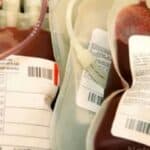 Švajcarska će pacijentima pružiti „sigurne transfuzije krvi“ od nevakcinisanih davalaca