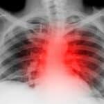 Australijski regulatori sakrili da vakcine izazivaju fatalne posledice