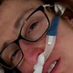 Australijskoj ženi odbijena transplantacija srca zbog statusa vakcinacije